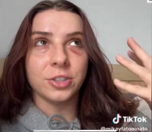 Mikayla Antoninato took to Tik Tok to highlight a random attack against her. Photo: TikTok