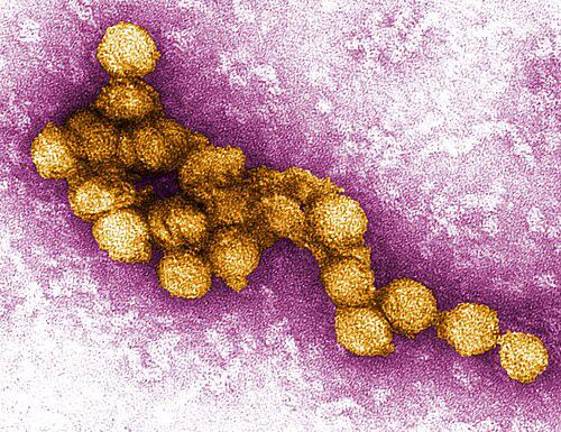 In rare instances, the disease can progress to West Nile neuroinvasive disease, a life-threatening condition.